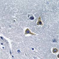 兔抗ARRDC2多克隆抗体