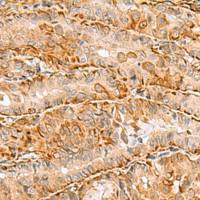 兔抗C3orf38多克隆抗体