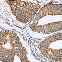 兔抗PRELID3B多克隆抗体