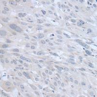 兔抗TYRP1多克隆抗体