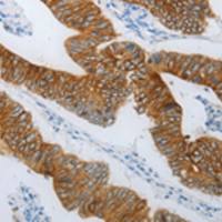 兔抗TMEM8B多克隆抗体