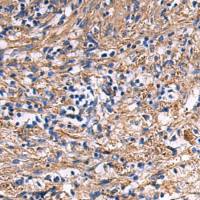 兔抗EPB41L2多克隆抗体