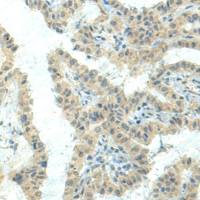 兔抗NPVF多克隆抗体