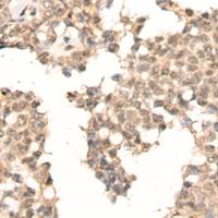 兔抗PRKDC多克隆抗体