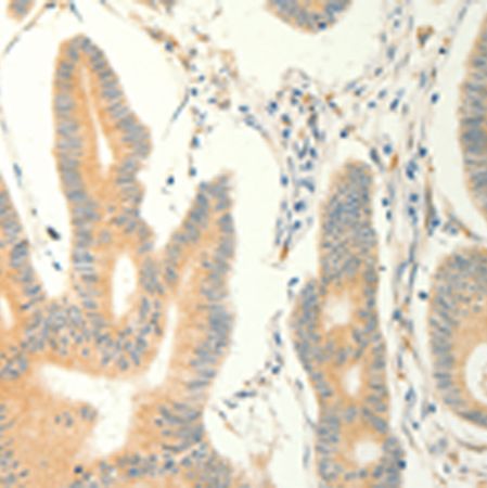 兔抗ERG多克隆抗体