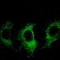 兔抗GFM2多克隆抗体