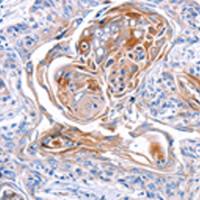 兔抗CX3CL1多克隆抗体