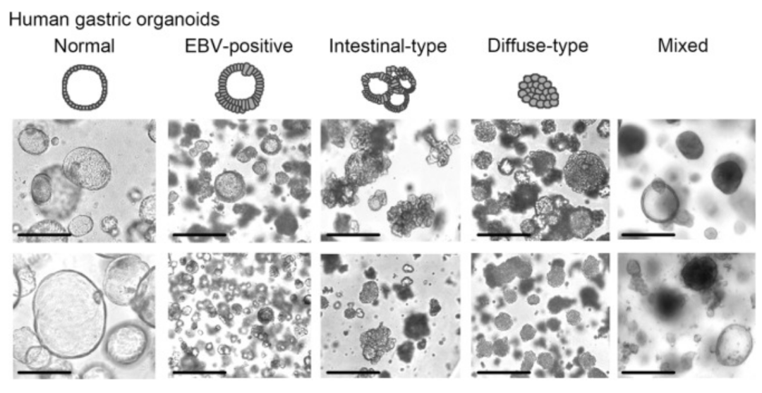 【答疑解惑】类器官培养50问-PDO篇（II）