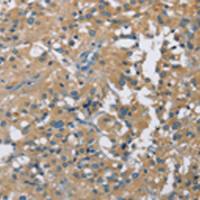 兔抗CAB39L多克隆抗体