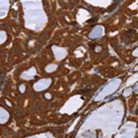 兔抗PPP2R3C多克隆抗体