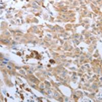 兔抗FGF1多克隆抗体