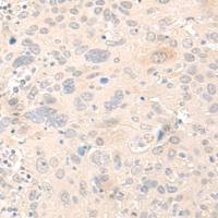 兔抗NLRX1多克隆抗体