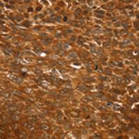 兔抗ELOA2多克隆抗体