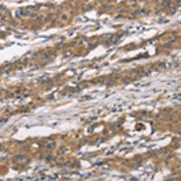 兔抗MTARC1多克隆抗体