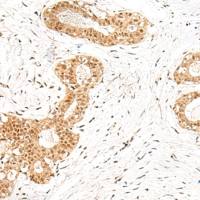 兔抗EVX1多克隆抗体