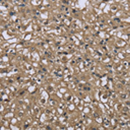 兔抗FBP1多克隆抗体