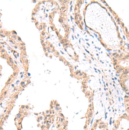 兔抗FANCE多克隆抗体