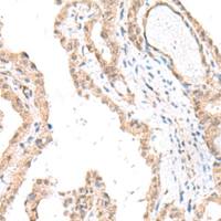 兔抗FANCE多克隆抗体