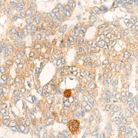 兔抗DBT多克隆抗体