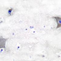 兔抗PDGFRA多克隆抗体