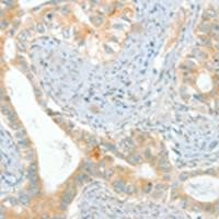 兔抗ACE多克隆抗体