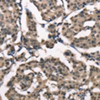 兔抗NSMCE3多克隆抗体