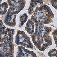 兔抗CHST10多克隆抗体