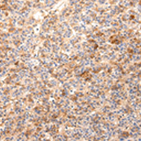 兔抗ZNF365多克隆抗体