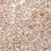 兔抗ZNF365多克隆抗体