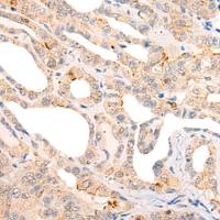 兔抗CORO6多克隆抗体