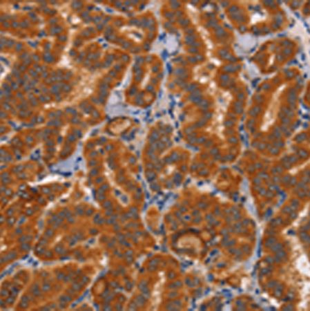 兔抗CTSC多克隆抗体