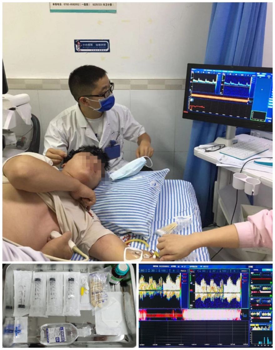 九江市第一人民医院神经电生理室成功完成九江市首例 TCD 发泡试验