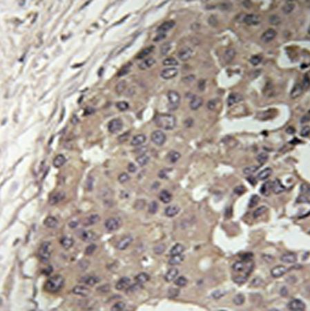 兔抗CSGALNACT1多克隆抗体