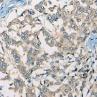 兔抗SLC5A3 多克隆抗体