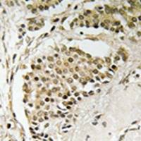 兔抗NOM1多克隆抗体