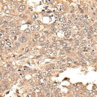 兔抗NES多克隆抗体