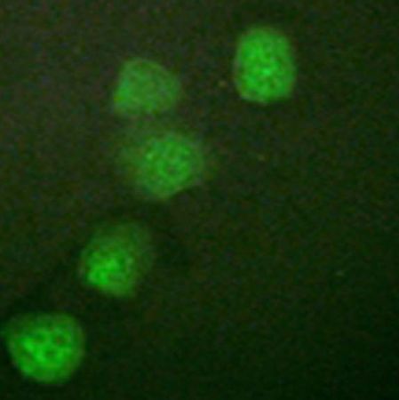 兔抗CCNE1(Ab-395)多克隆抗体