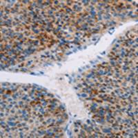 兔抗AMOTL2多克隆抗体