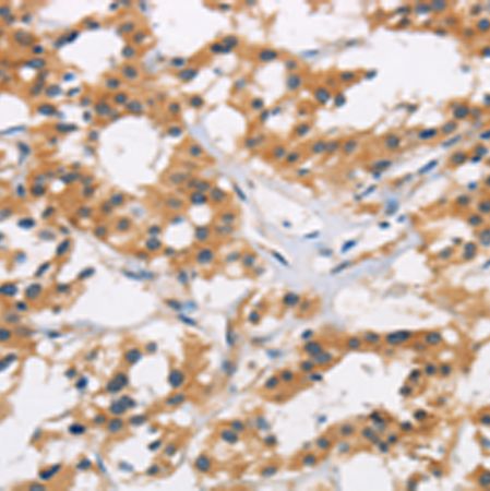 兔抗AXIN2多克隆抗体