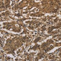 兔抗DUSP23多克隆抗体