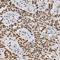 兔抗MYEF2多克隆抗体