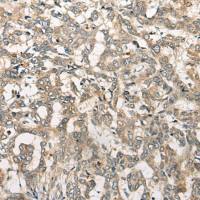 兔抗YTHDF1多克隆抗体