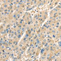 兔抗PTGS2多克隆抗体