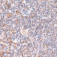 兔抗GMDS多克隆抗体