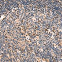 兔抗TNFRSF12A多克隆抗体