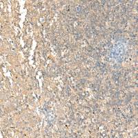 兔抗NARS1多克隆抗体