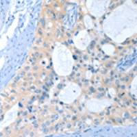 兔抗ANKRD54多克隆抗体