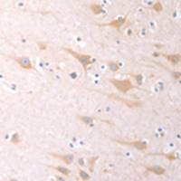 兔抗SCGB1A1多克隆抗体