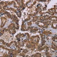 兔抗GRK1多克隆抗体