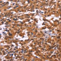 兔抗MSH4多克隆抗体